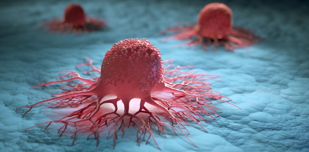 【分享】德国Nordmark助力TILs细胞疗法从肿瘤组织中提取TILs的GMP级胶原酶方案