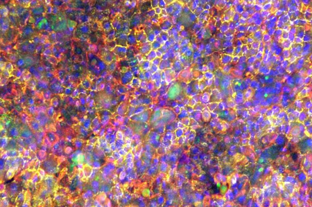 AKITA 器官芯片 | 肺泡上皮-内皮屏障芯片