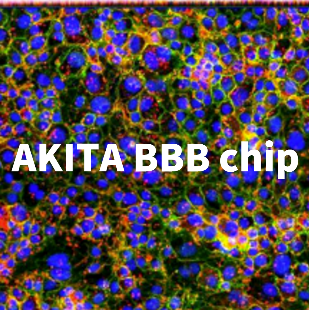 AKITA器官芯片 | iPSC来源的神经类器官&血脑屏障模型