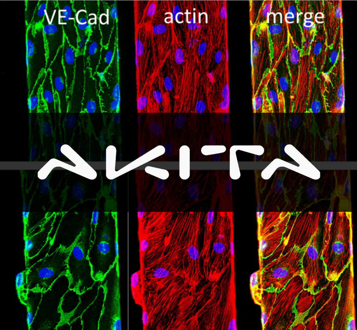 AKITA 3D血管模型1 | 静脉畸形（VMs）