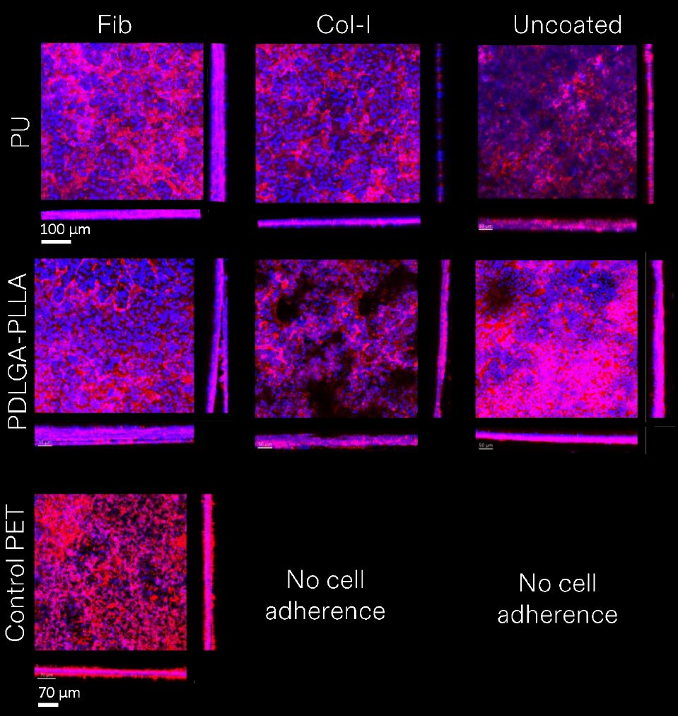 第14天Caco-2上皮的共聚焦显微镜图像