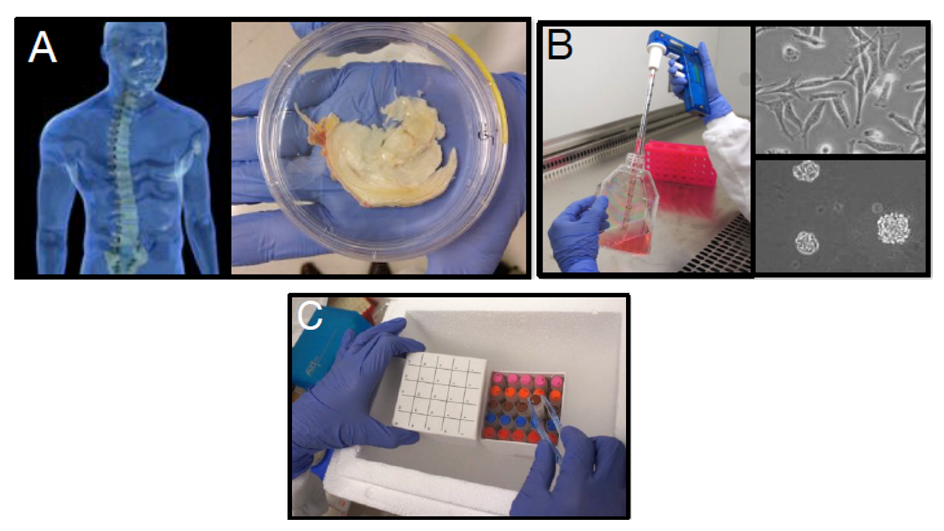 制备椎间盘细胞的过程
