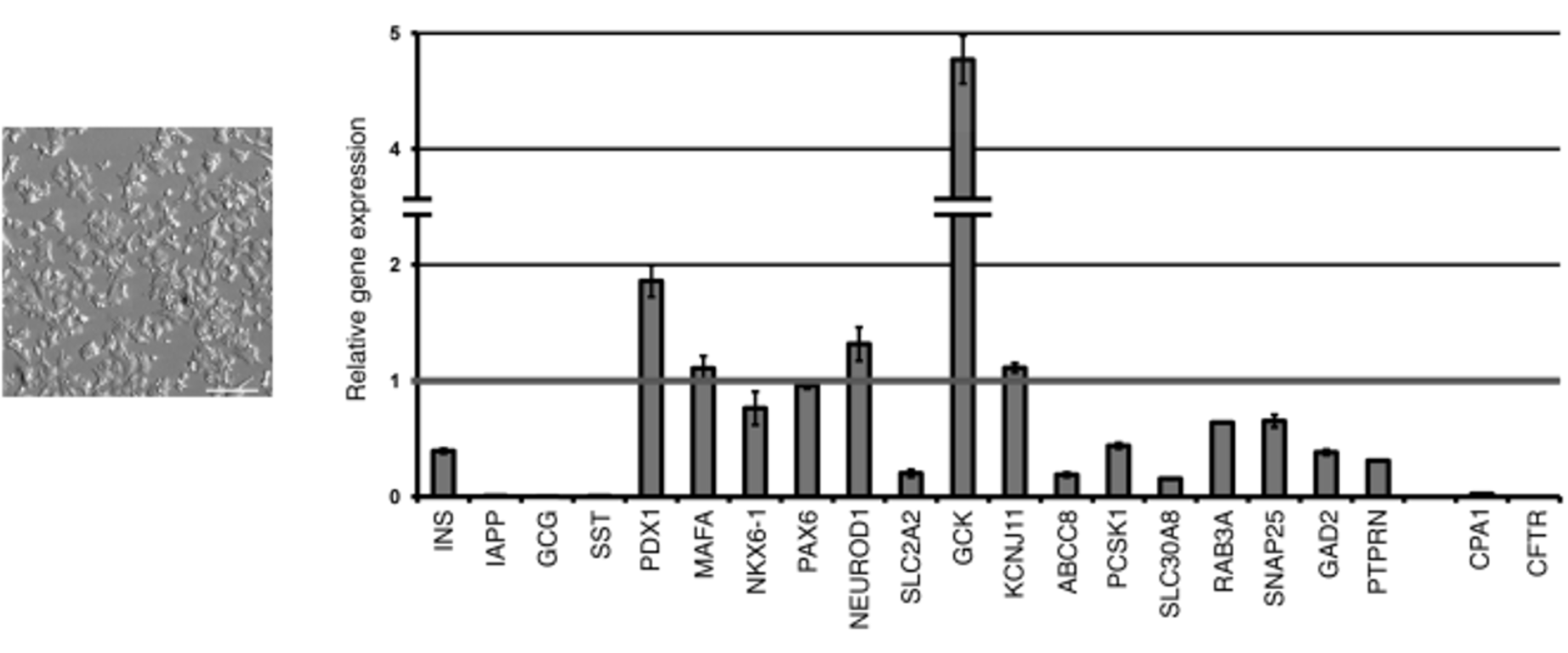 EndoC-βH1细胞的基因表达谱和形态图