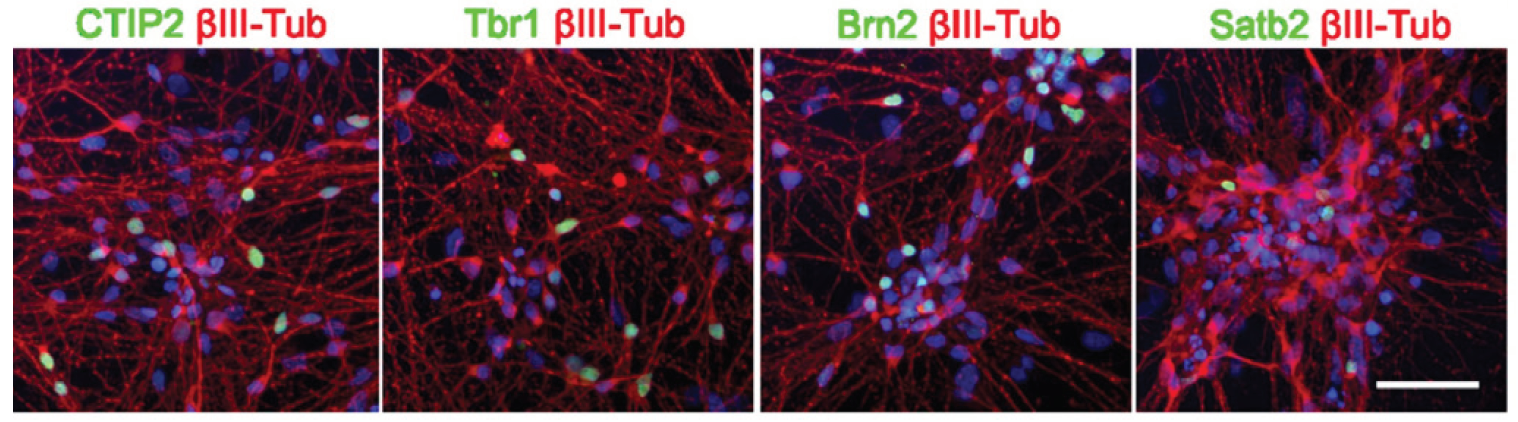 对Biolaminin上培养分化得到的皮质特异性神经元进行免疫荧光染色检测深层和上层标志物