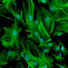 肝非实质细胞（NPC）