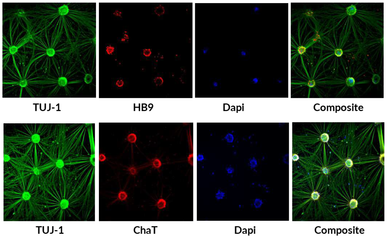 axoCells人诱导多能干细胞衍生的运动神经元的免疫细胞化学染色（未受影响的供体）