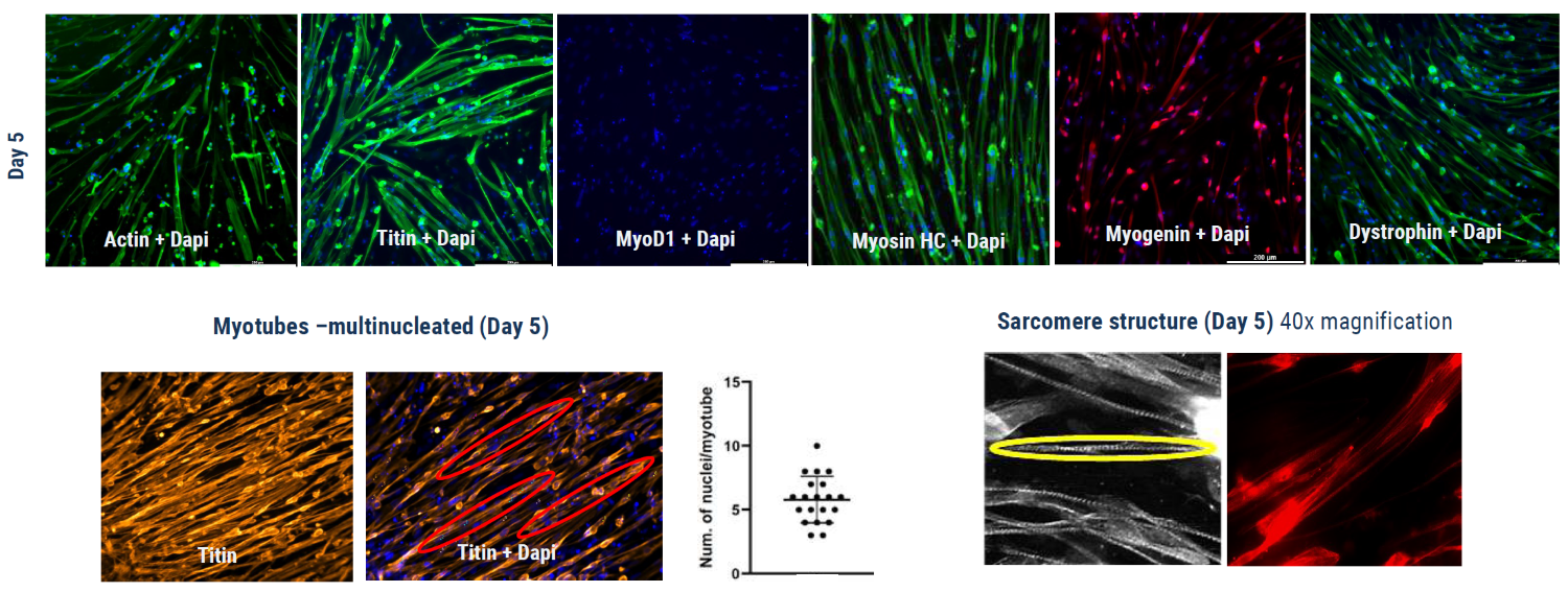 人iPSC衍生的肌管