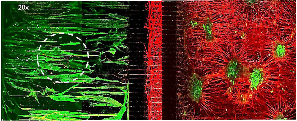 神经突在通道和微通道中穿过，并进入骨骼肌区域（Tuj1表达呈红色）