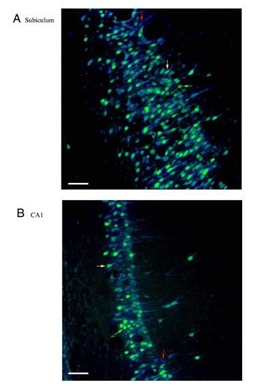 True Blue (TB)是一种荧光逆行示踪剂，用于周围神经系统实验研究