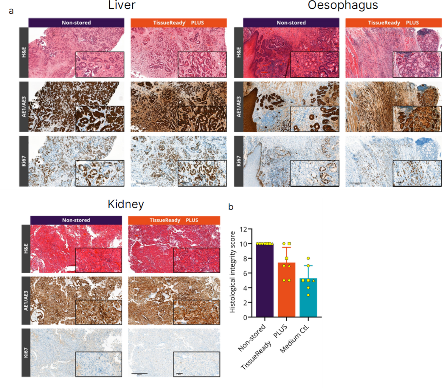 使用TissueReady PLUS在室温下存储2天的癌症组织能够保持其组织学结构和病理学标记物