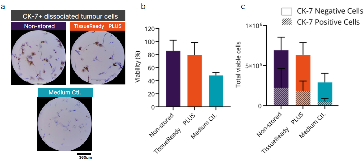 从新鲜癌症组织和通过TissueReady PLUS保存的癌症组织中分离的细胞在细胞活力和数量上相当