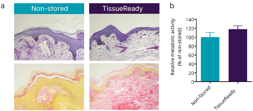 使用TissueReady保存新鲜收集的腹部皮肤活检样本