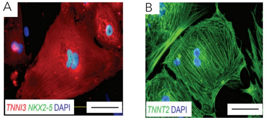 分化第34天时CMs的特征性标志物免疫组织化学染色代表性图像