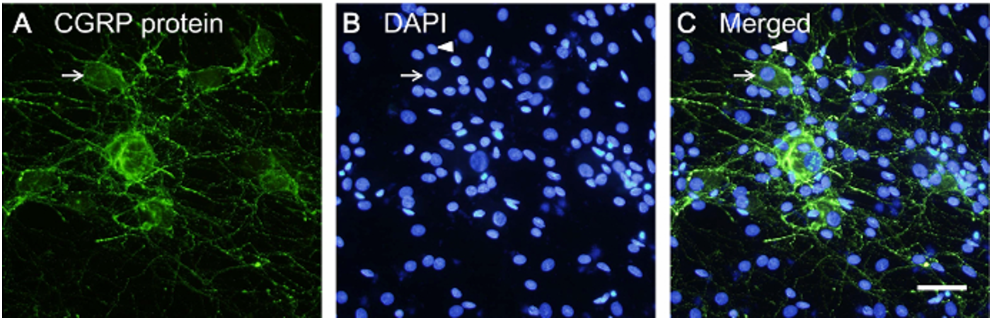 DRG神经元细胞的细胞形态学特征