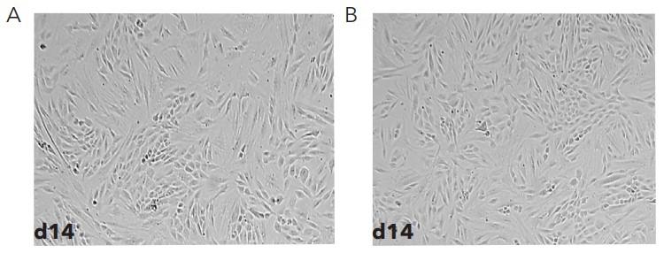 成人人成纤维细胞在LN521和511上培养14天时细胞汇合度明场图
