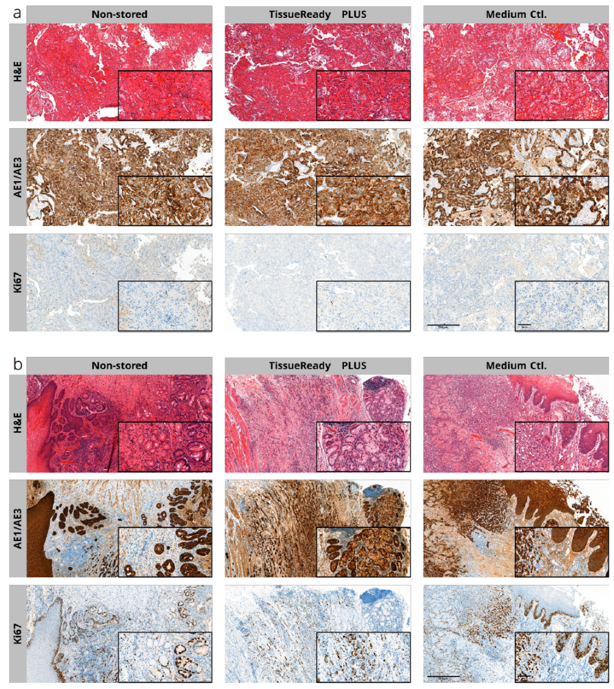 在室温下采用TissueReady PLUS保存2天的肾癌组织（a）和食管癌组织（b）