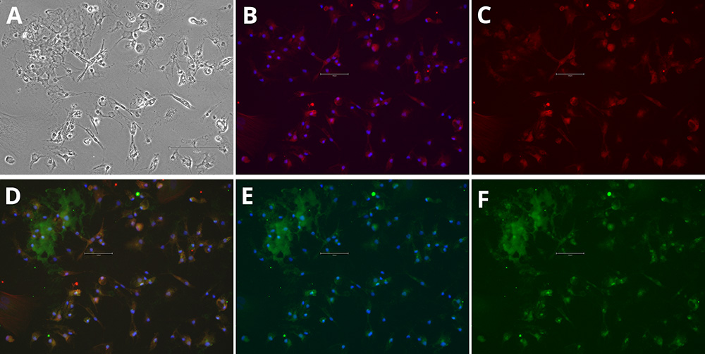 分化 iPSC 中小胶质细胞标志物的免疫细胞化学分析