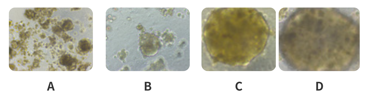 肝球体形成的图像