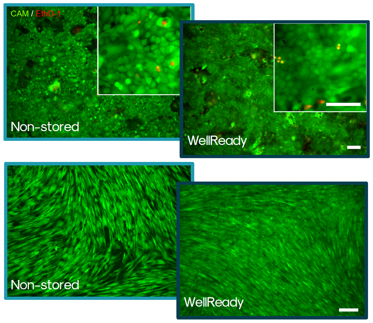 通过钙黄绿素 - AM/乙锭同源二聚体-1 染色法对真皮角质形成细胞（上）和真皮成纤维细胞（下）在储存5天前后的活/死细胞染色情况