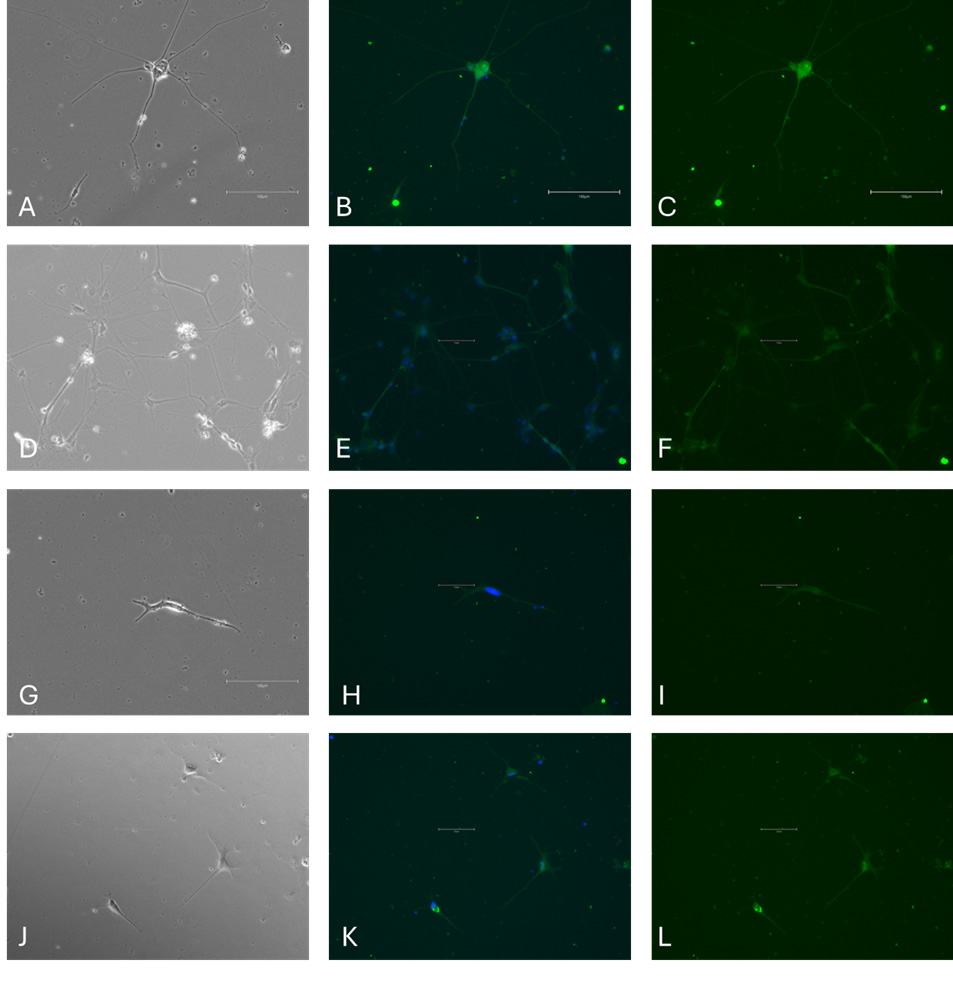 分化型iPSC中星形胶质细胞标记物的免疫细胞化学染色